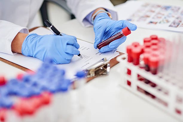 LAB Closeup shot of a scientist examining a blood sample and recording findings in a lab